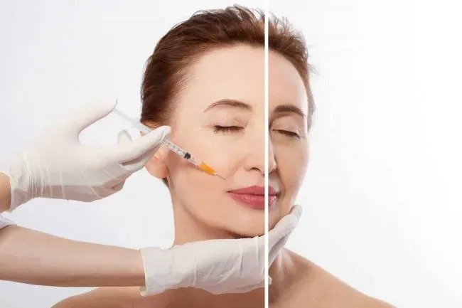 Tiêm Filler Có Bị Chảy Xệ Không? ⚡️ Lưu Ý Sau Khi Tiêm Filler