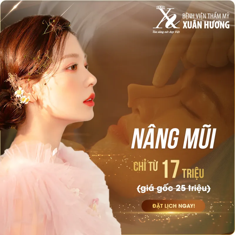 Top +10 Địa Chỉ Nâng Mũi Đẹp ở Hà Nội ⚡️ An Toàn & Uy Tín Nhất