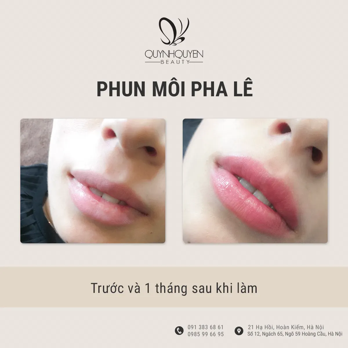 TOP 10 Địa Chỉ Phun Môi Tại Hà Nội Uy Tín & Tạo Môi Đẹp Tự Nhiên